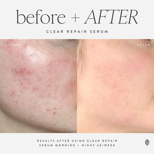 Clear Repair Serum