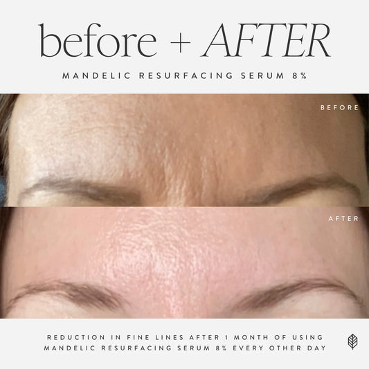 Mandelic Resurfacing Serum 8%