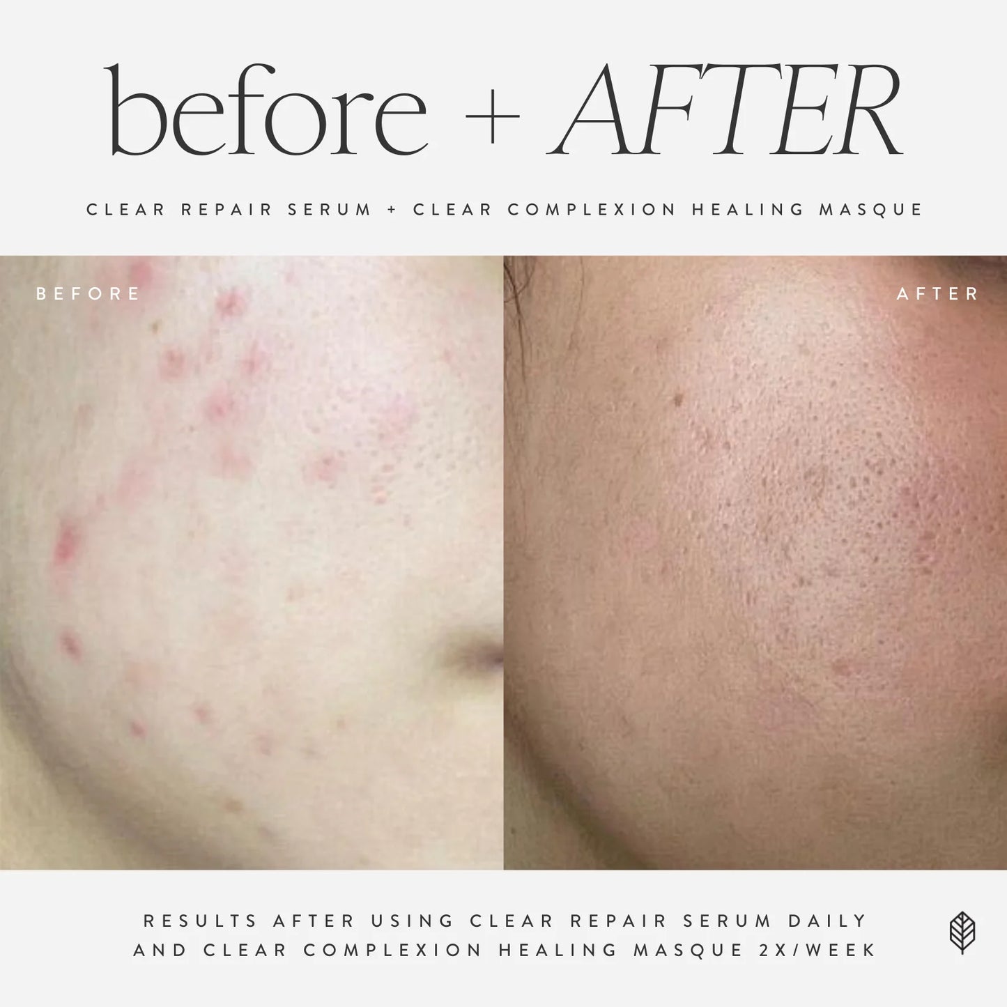 Clear Repair Serum